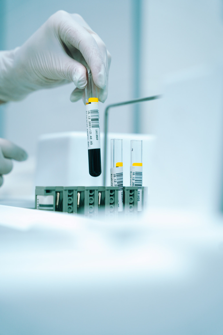 Qualitative analysis