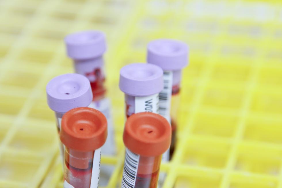 Here's how you know which blood tests require fasting