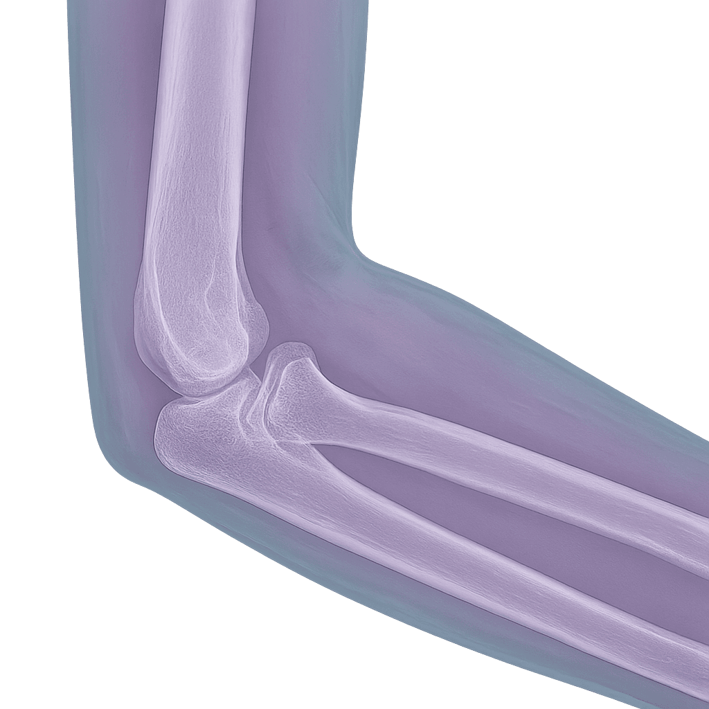 MRI Elbow