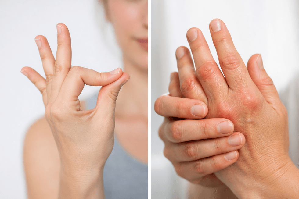 EDS eller reumatism? Så vet du skillnaden