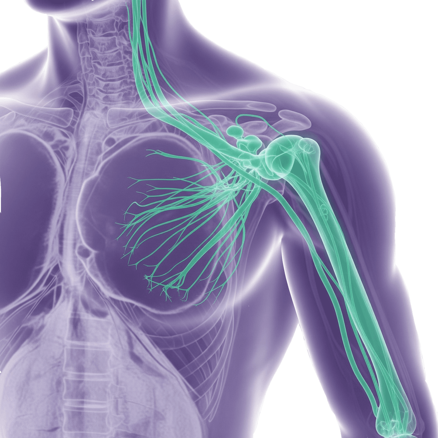 MRI Plexus brachialis