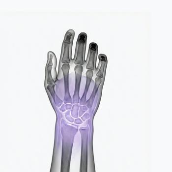 MRI Wrist