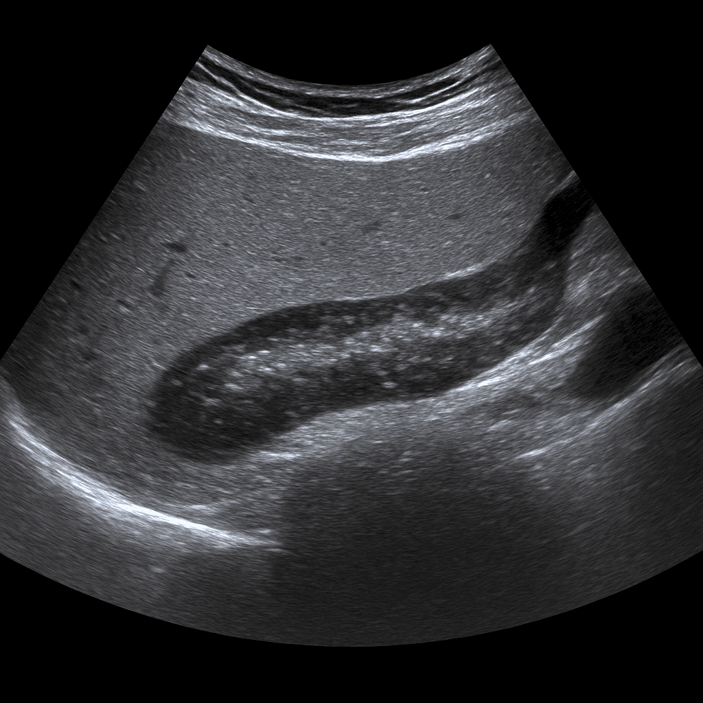 Ultrasound Pancreas