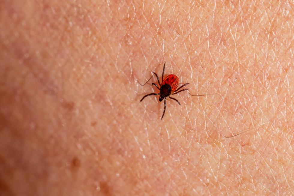 “Är det farligt om fästingens huvud är kvar?” Och 9 andra vanliga frågor och svar om fästingar