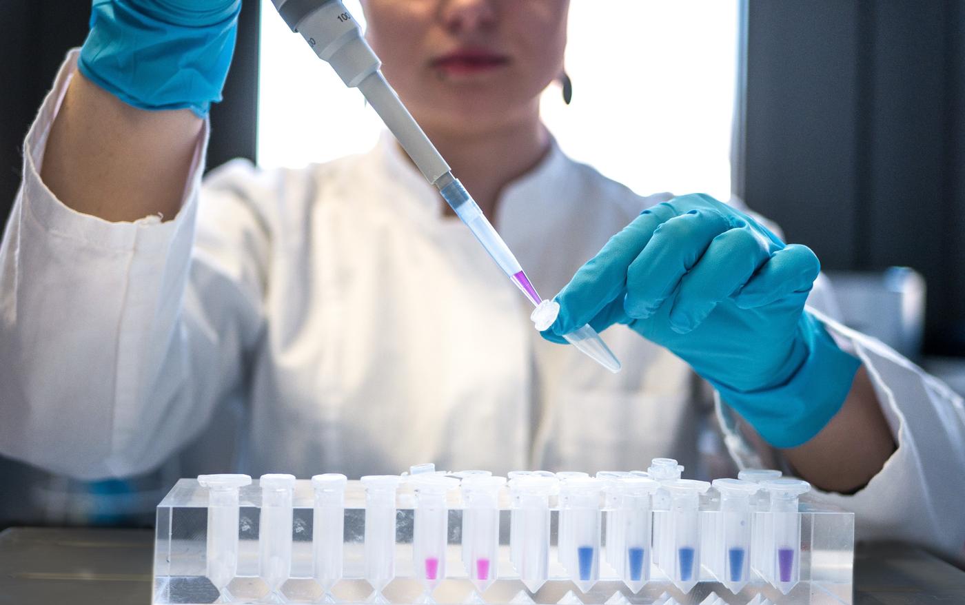 PCR test - same day