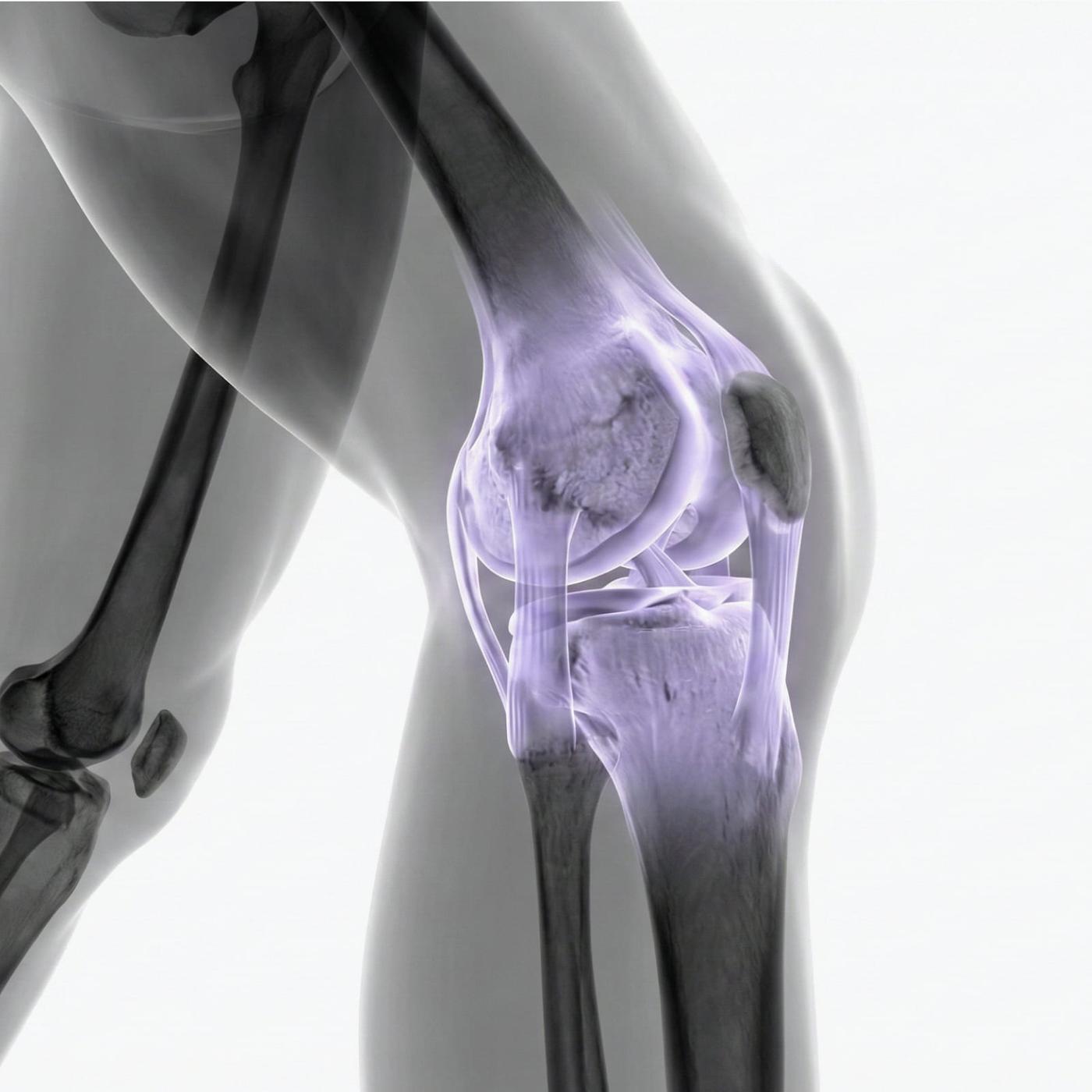 MRI Knee