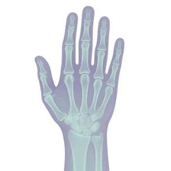 MR Hand