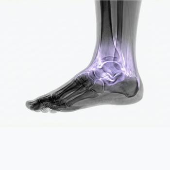 MRI Ankle