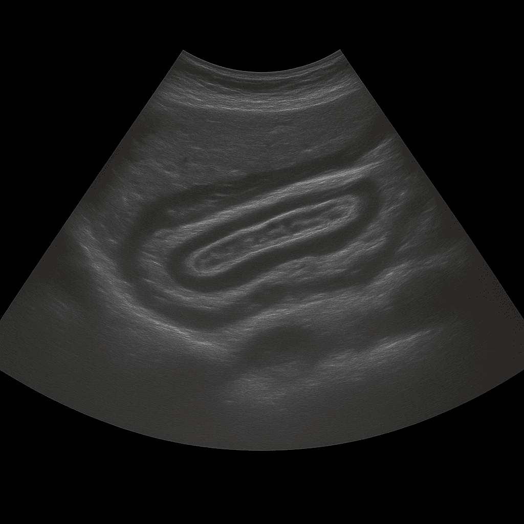 Ultrasound Abdominal