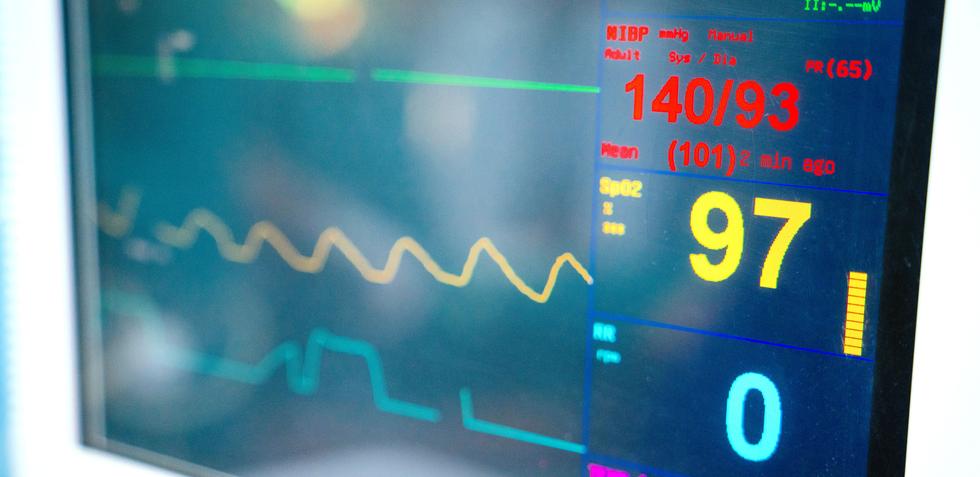 Vad visar ett Långtids-EKG