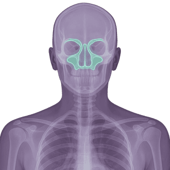 MR Sinus