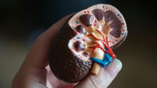 Kidney diseases - How to reduce your risk