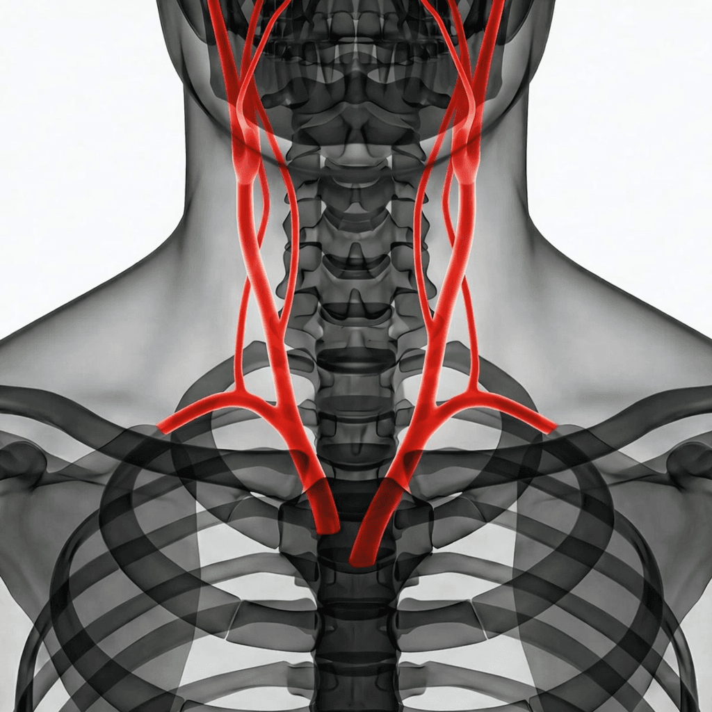CT carotid arteries - 3D Angio