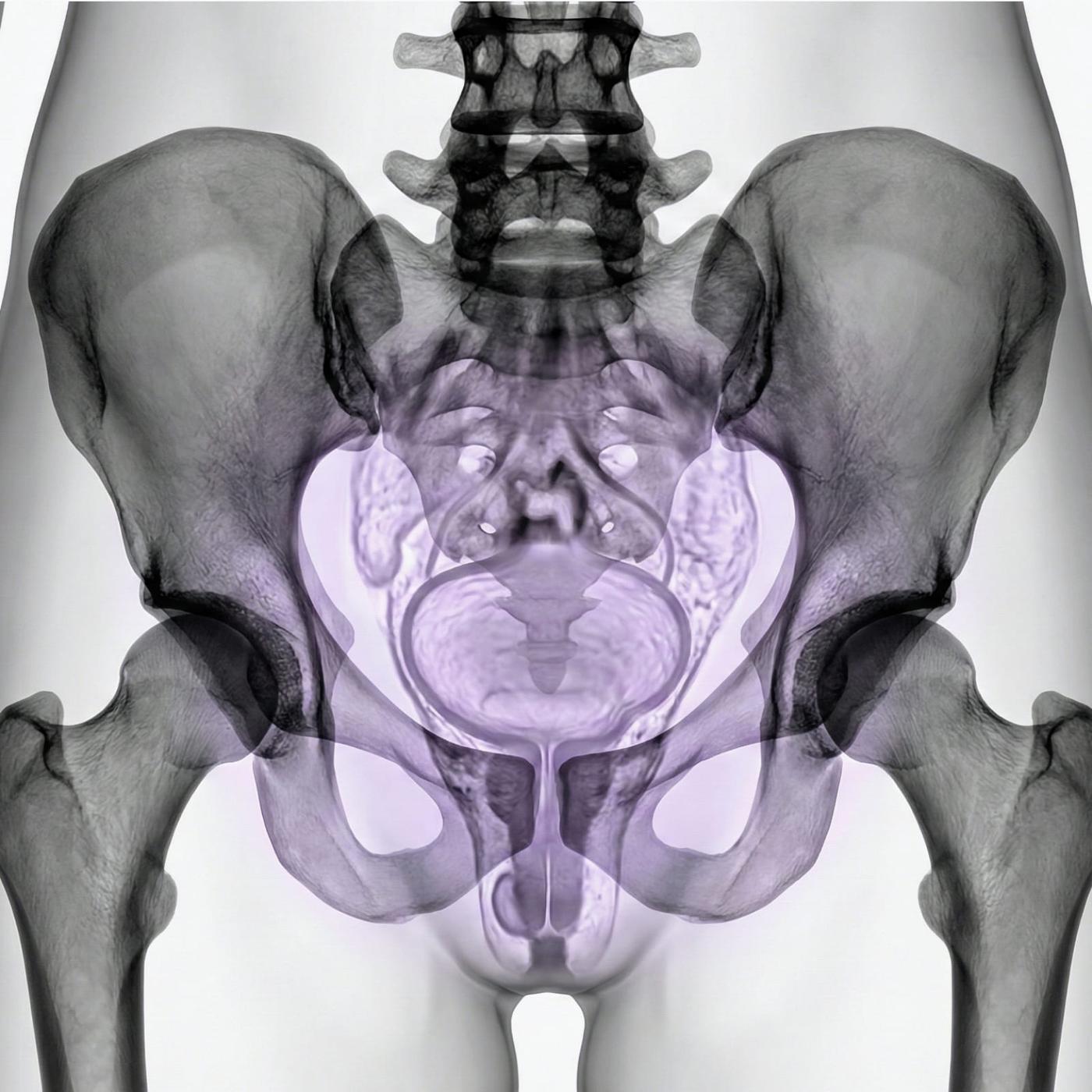MRI Pelvis