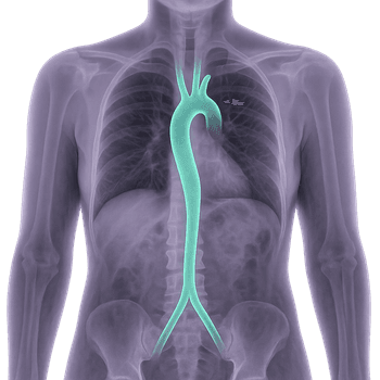 MRI Aorta